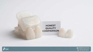 Clip-On Veneers Dentist Quality: Are They Worth It?