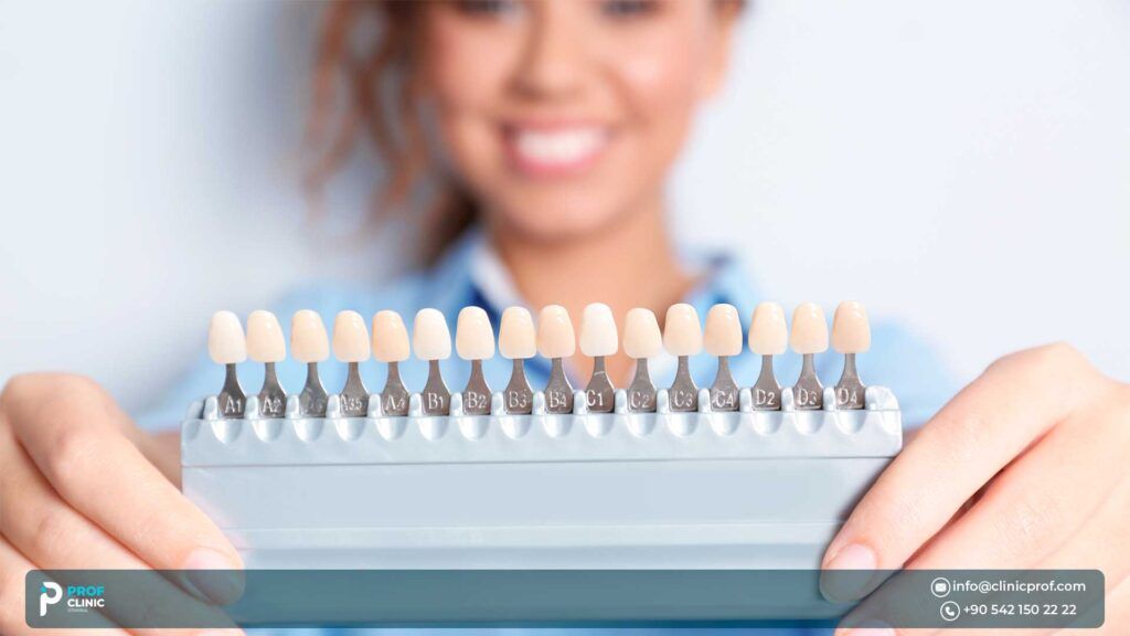 Composite Veneers Cost
