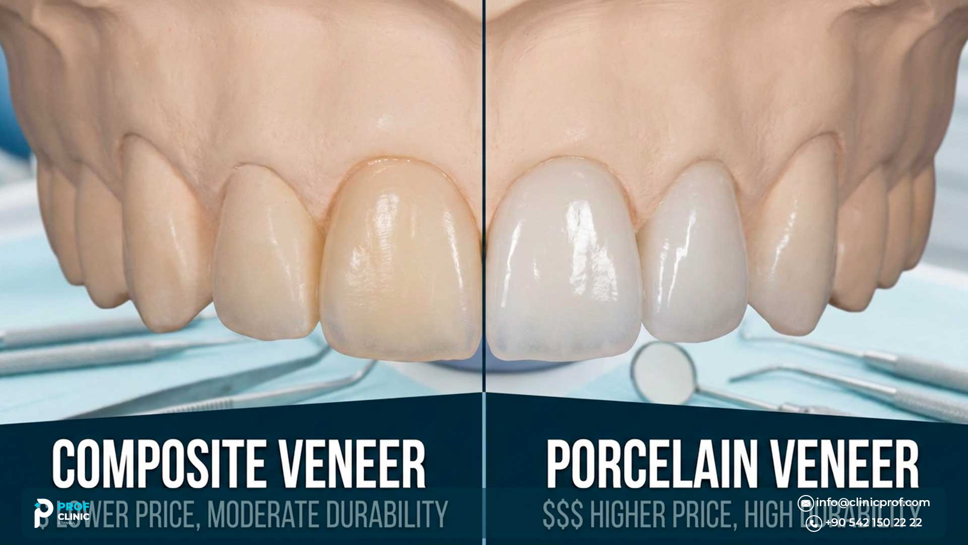 Composite vs. Porcelain Veneers: Everything You Need to Know