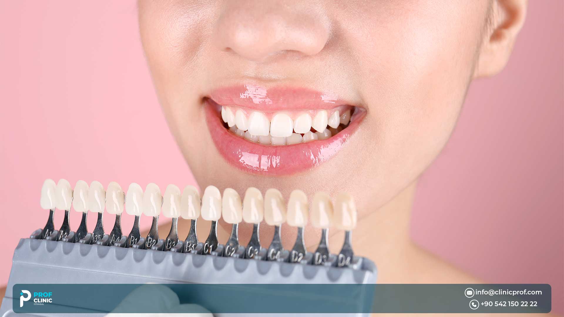 Cost of  Temporary Veneers in Turkey