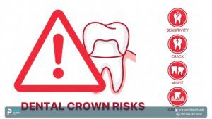 Dangers of Dental Crowns: What You Need to Know