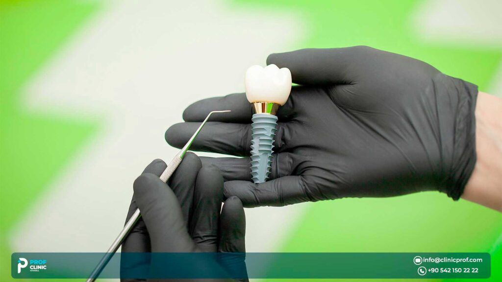 Dental implants