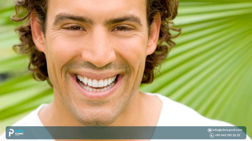 Different types of natural smile
