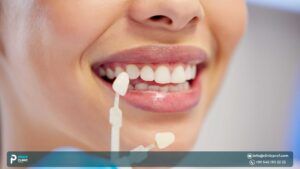 Dive into everything you need to know about direct veneers, including their advantages and disadvantages, pricing in Turkey, and other key details.