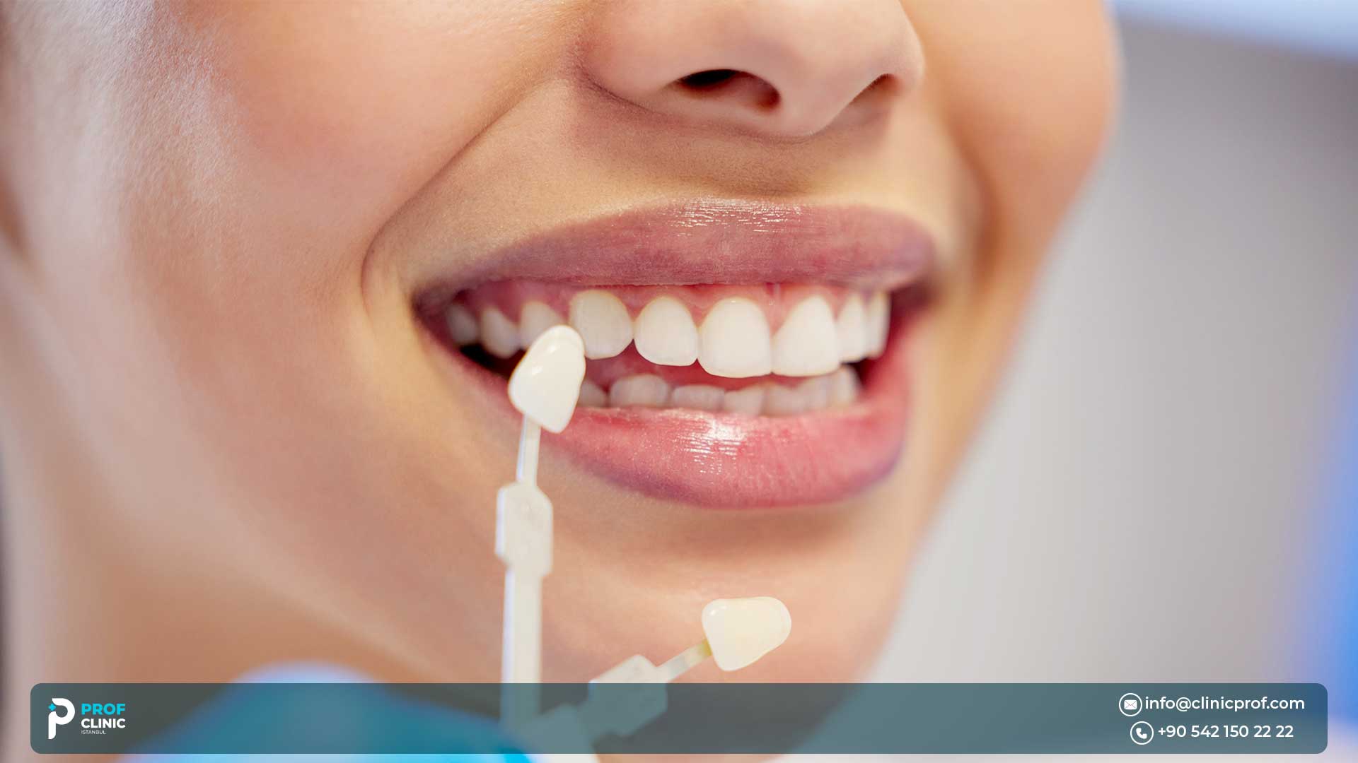 Dive into everything you need to know about direct veneers, including their advantages and disadvantages, pricing in Turkey, and other key details.