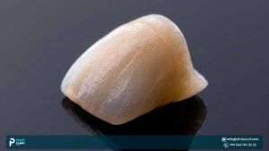 Emax Crowns: Features, Drawbacks & Prices