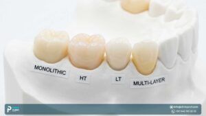 Exploring the Different Types of Zircon Crowns 2024 : Which One is Right for You?