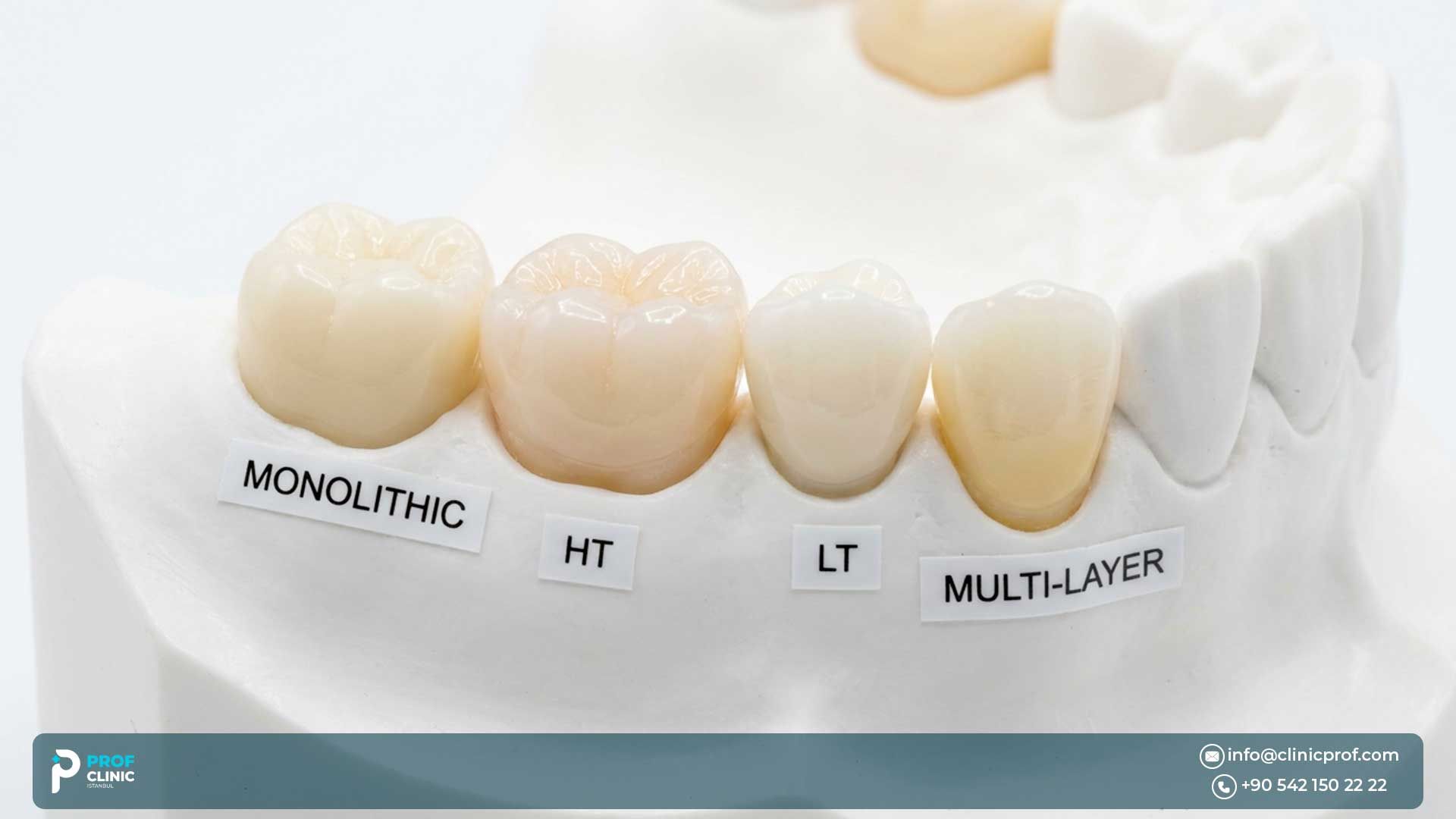 Exploring the Different Types of Zircon Crowns 2024 : Which One is Right for You?