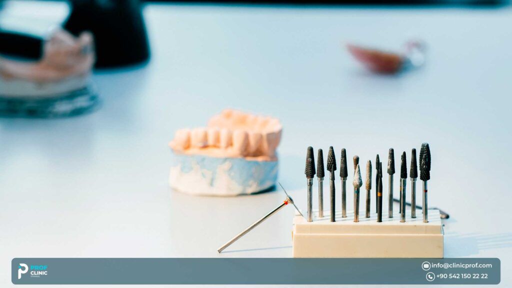 Factors Affecting the Cost of Full Mouth Dental Implants