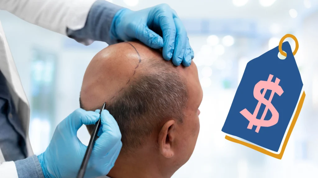 Factors Affecting the Cost of Hair Transplant in Turkey