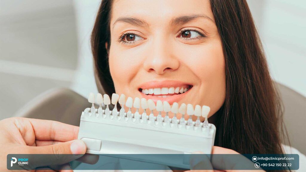 Factors That Affect Veneers Price
