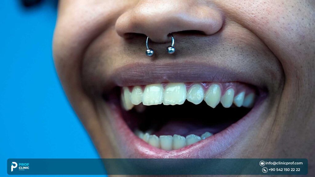 Freddie Mercury’s Teeth and Their Impact on His Image