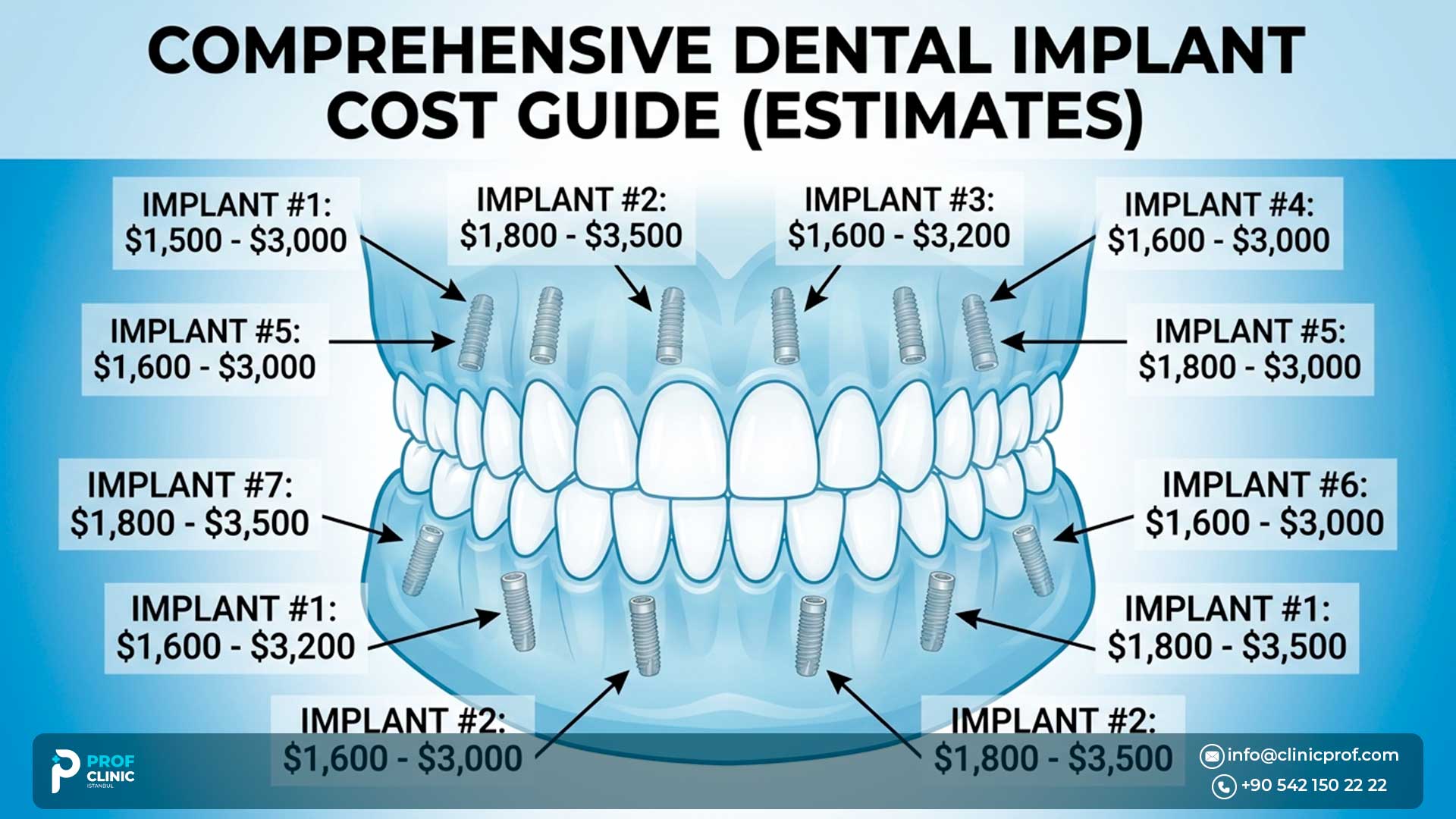 Full Mouth Implants Cost - تكلفة زراعة الأسنان في تركيا وفي العالم