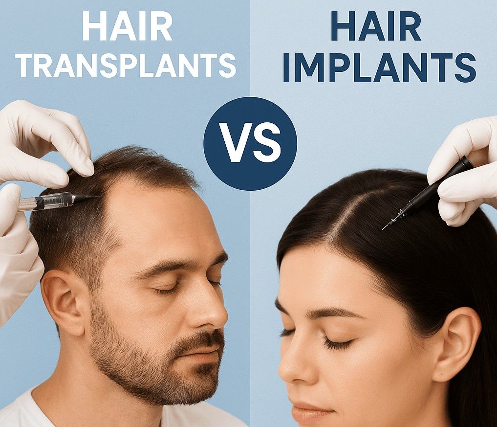 Hair Implant vs Hair Transplant (Full Guide)