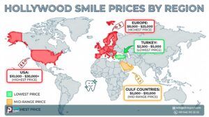 Hollywood Smile Costs: Turkey vs Global Prices (Guide 2025)