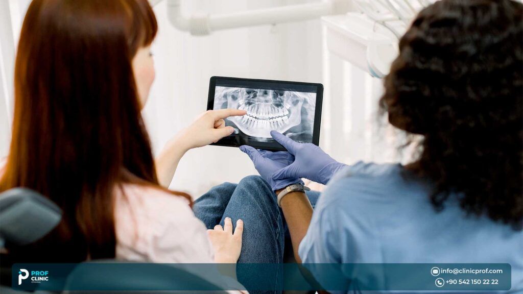 Hollywood Smile In Turkey -Hollywood smile clinic in Turkey - Prof Clinic Istanbul