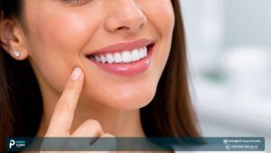 Hollywood Smile: Types, Styles, & What to Choose?