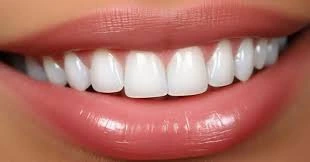 Hollywood Smile Types, Styles, & What to Choose