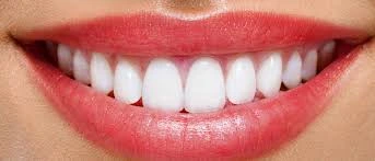 Hollywood Smile: What is Best?
