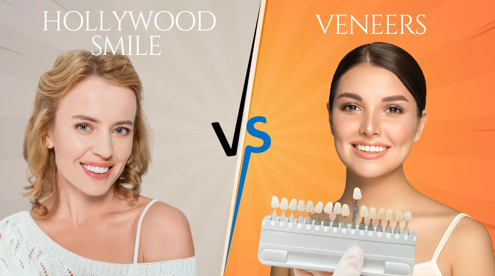 Hollywood Smile vs Veneers