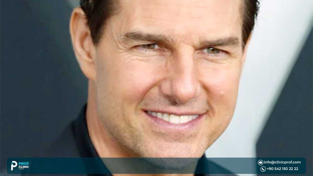 How Did Tom Cruise Fix His Teeth?