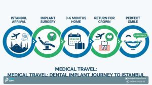 How Long Do Dental Implants Take in Turkey
