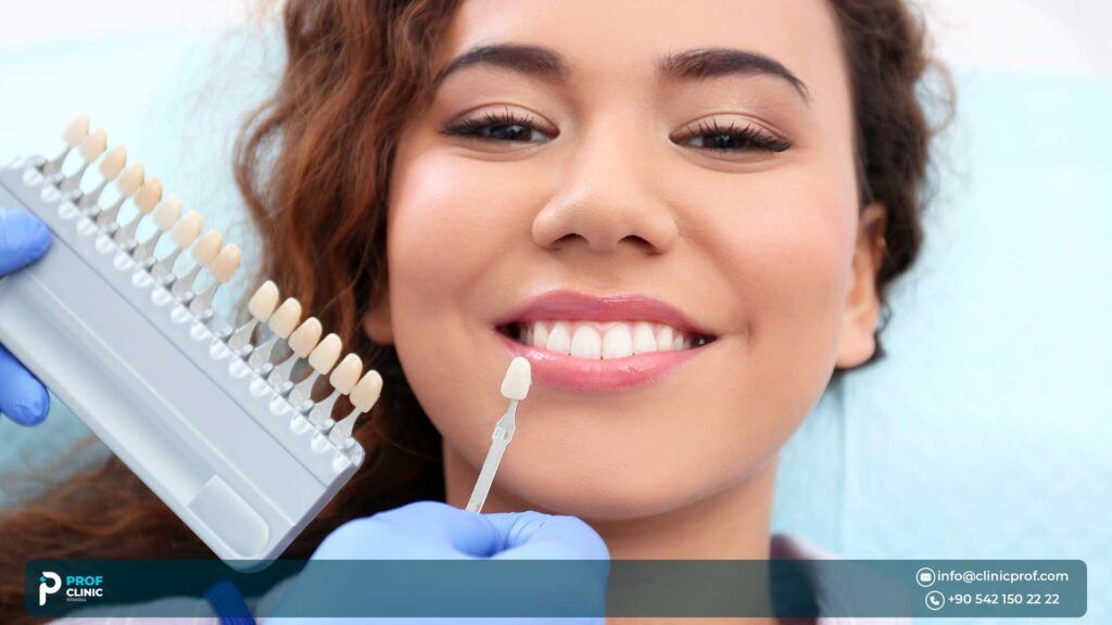 How Much Do Veneers Cost in Turkey?