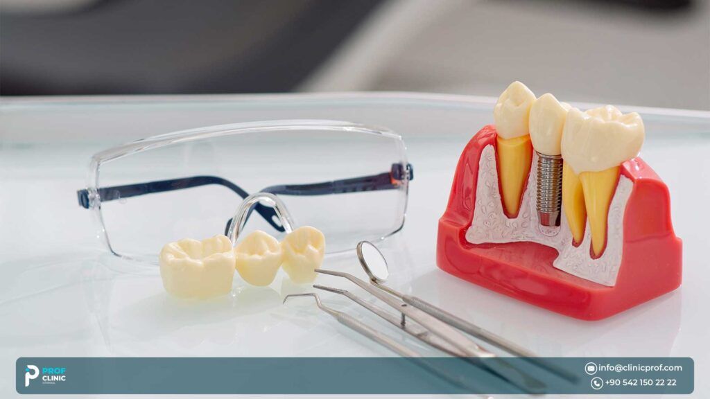 How to choose between an implant and a bridge