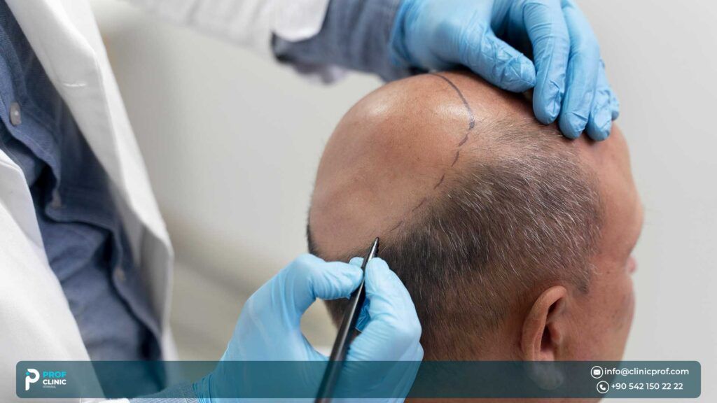 Medical Tourism concept: USA vs Turkey