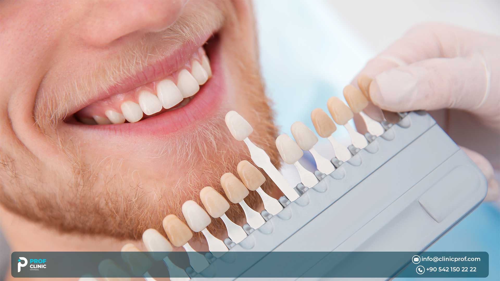 Prof Clinic for the best Composite Veneers