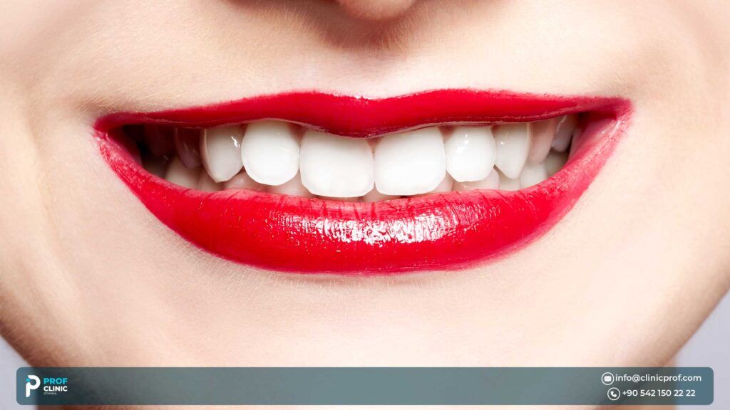 Prof Clinic is the best clinic for creating your perfect teeth