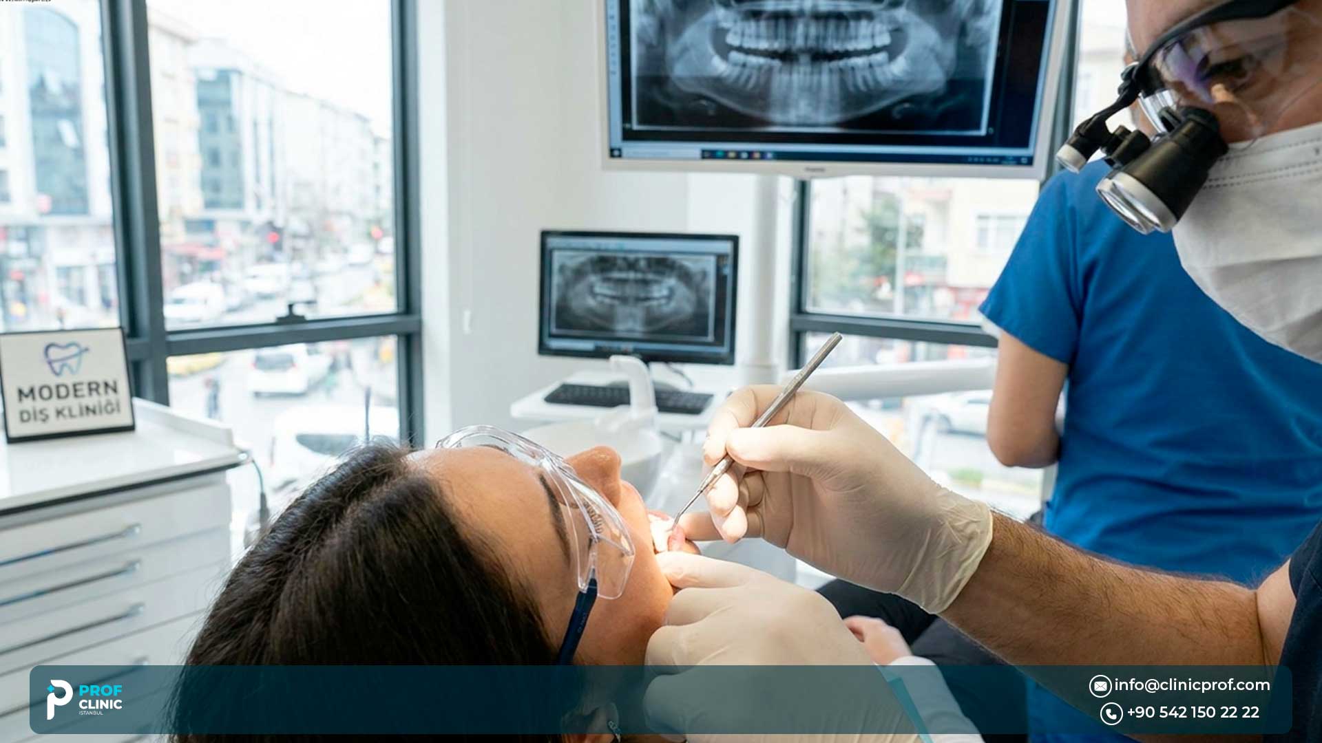 Pros and Cons of Direct Veneers for a Hollywood Smile