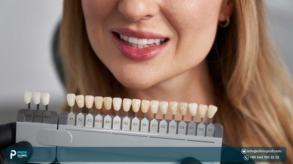 Pros and Cons of Feldspathic Veneers