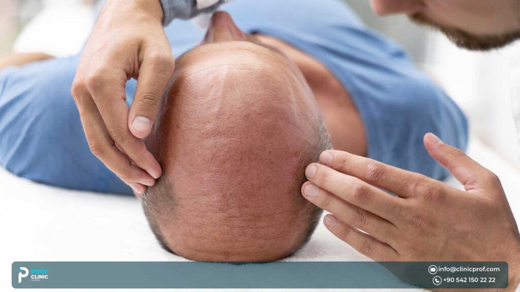 Pros of Hair Transplant in Turkey
