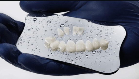 Composite Veneers: Everything You Need to Know