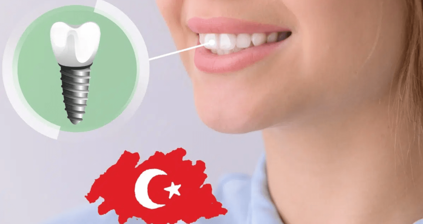 Is it safe to have dental implants in Turkey?