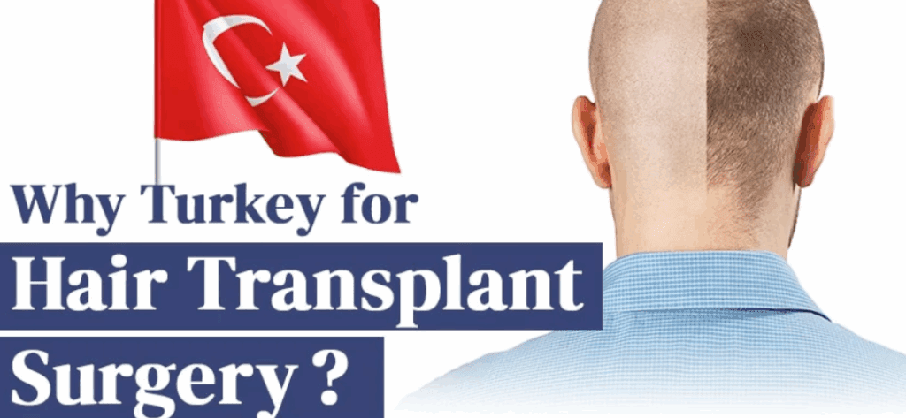 Why Choose Turkey for Hair Transplants?