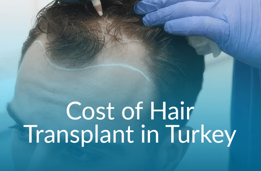 Turkey Hair Transplant Cost in 2025: What You Need to Know