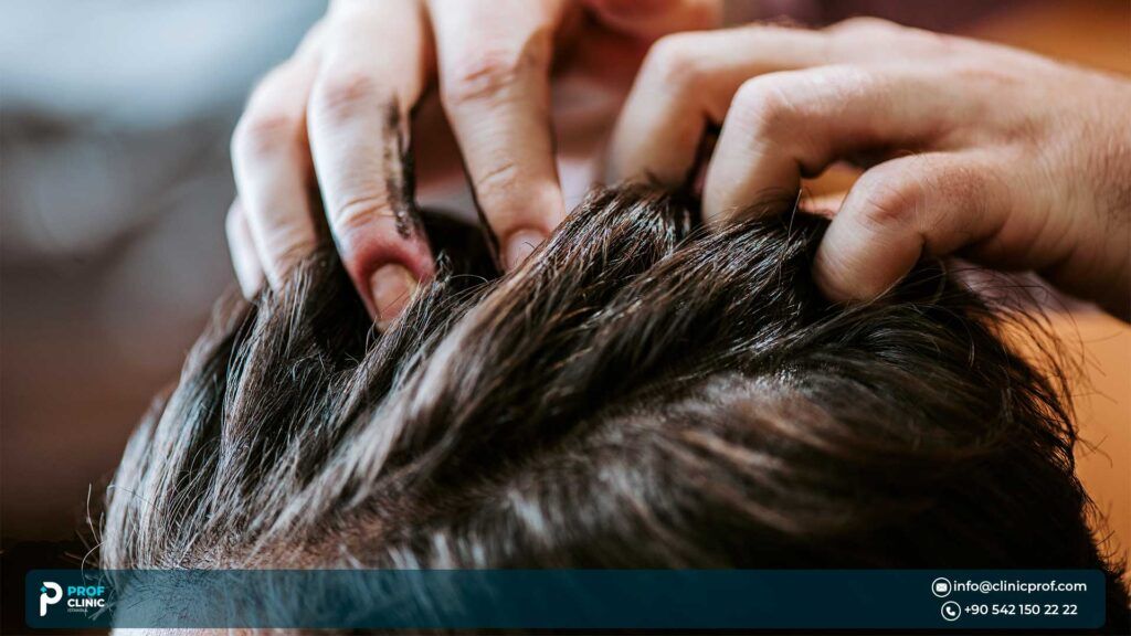 Should I go to Turkey for a hair transplant?