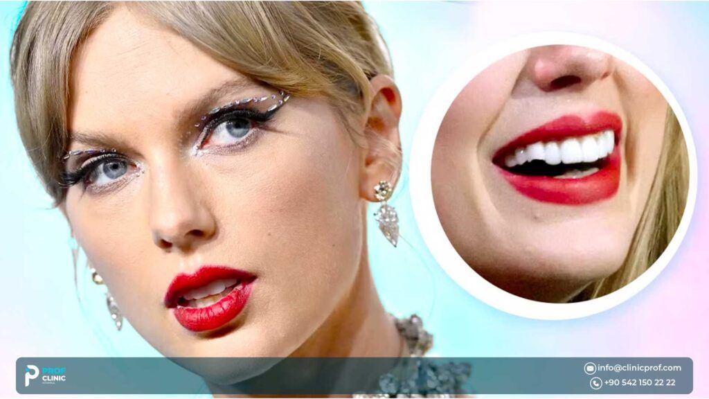 Signs That Taylor Swift May Have Veneers