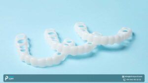 Snap-On Smile: All You Need to Know