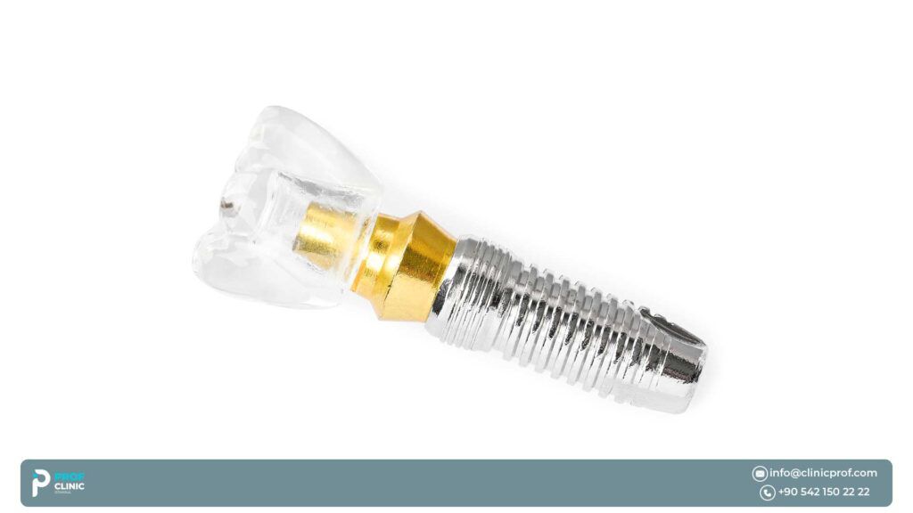 Straumann implants