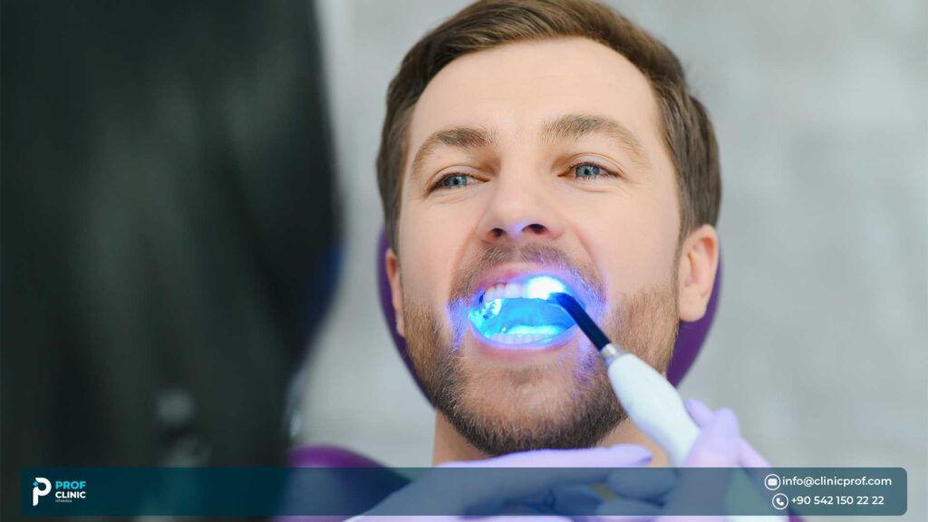The Best Cost Hollywood Smile in Istanbul Turkey - Prof Clinic Istanbul