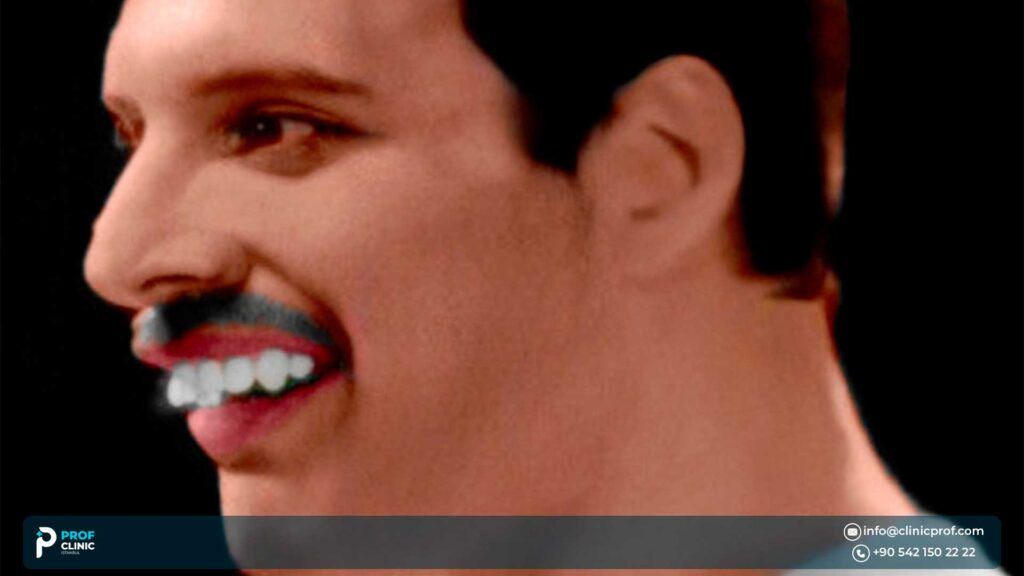 The Role of Freddie Mercury’s Teeth in His Legacy