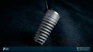 Titanium Dental Implants: Cost, Pros & Cons