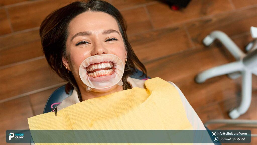 Types of Hollywood Smile in Istanbul