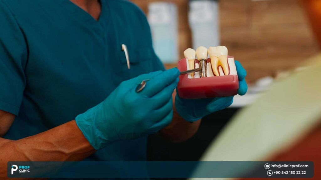 What Are Dental Implants?
