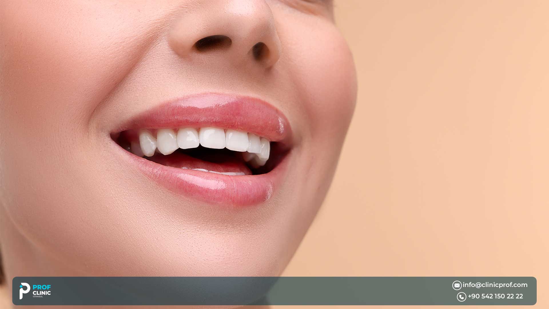What Are Perfect Teeth
