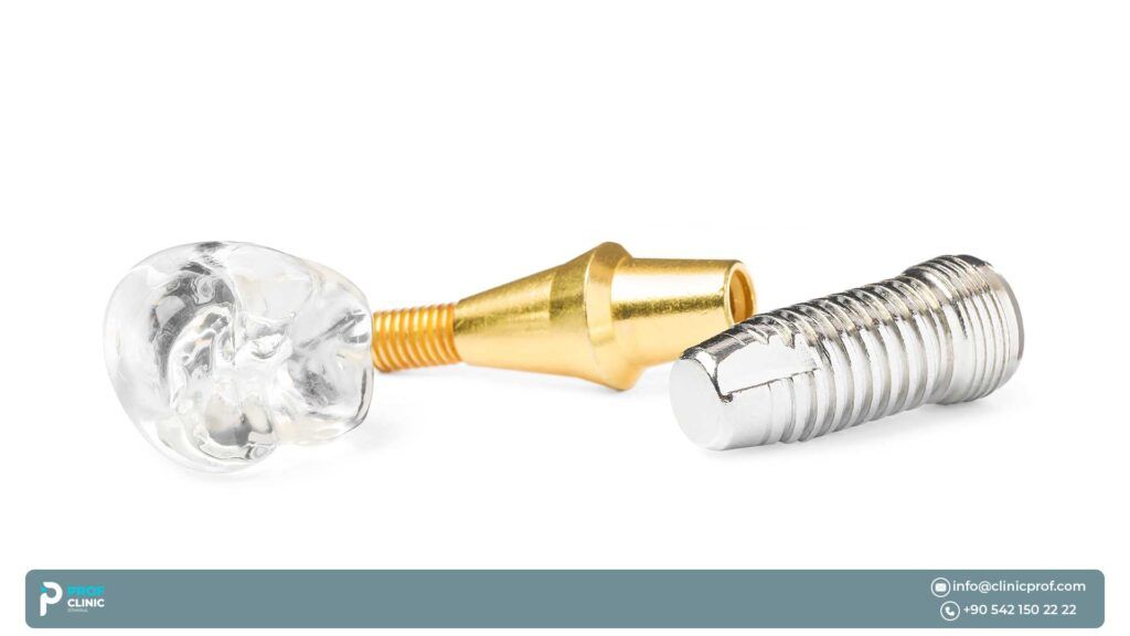 What Are Straumann and Nobel Biocare Dental Implants?