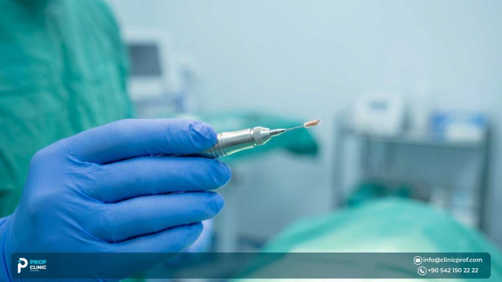 What Is DHI Hair Transplant?